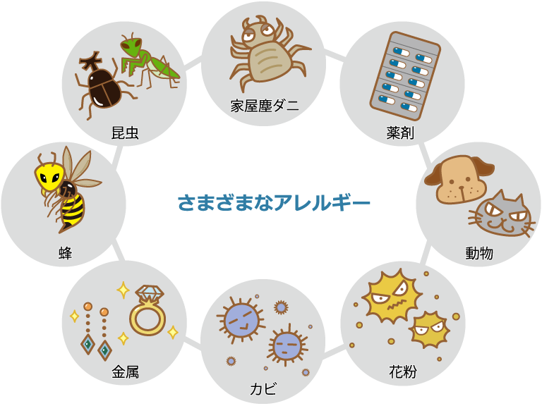 図：さまざまなアレルギー