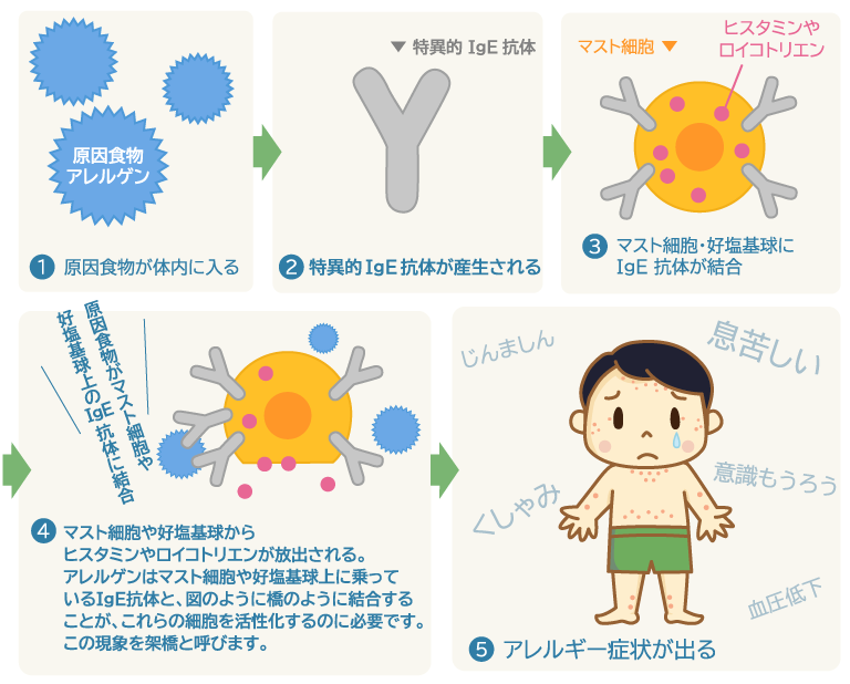 図：食物アレルギーの発症のメカニズム